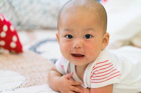 5 Cara Mengatasi Bintik Merah pada Kulit Bayi

