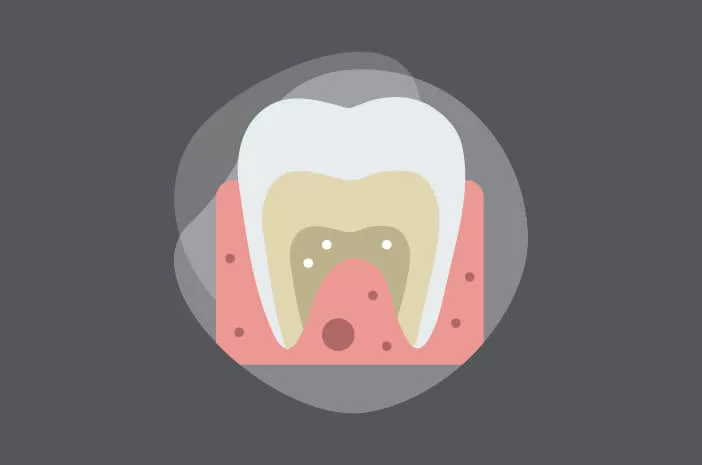 Manfaat Panoramic Gigi untuk Perawatan Orthodonti (Kawat Gigi)