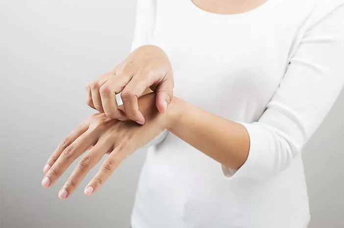 Cara Mengatasi Kulit Melepuh Akibat Dermatitis Kontak