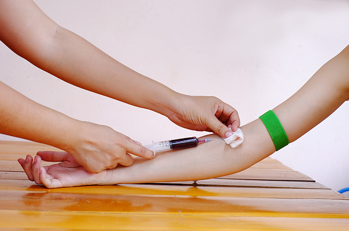 Ini 3 Tes Untuk Mendeteksi Hiv Dan Aids