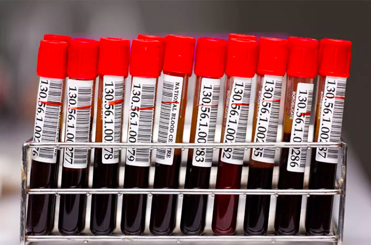 Cek Anti HSV2 IgM