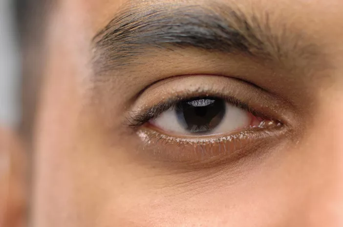 Waspada Endoftalmitis, Penyakit Mata yang Bisa Sebabkan Kebutaan