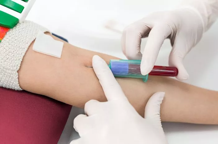 Darah Jadi Sampel Utama untuk Tes Hematologi, Benarkah?