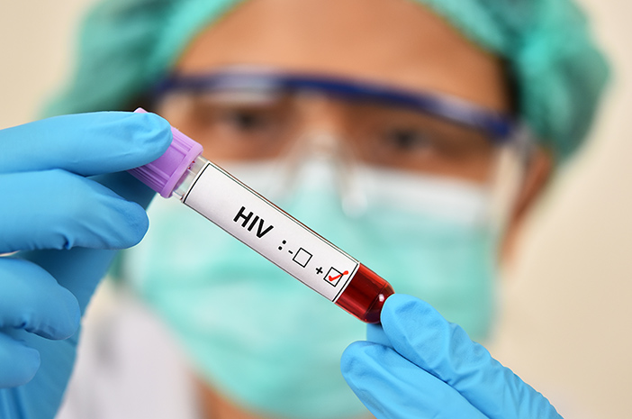 2 Tes untuk Mendeteksi HIV AIDS dalam Tubuh