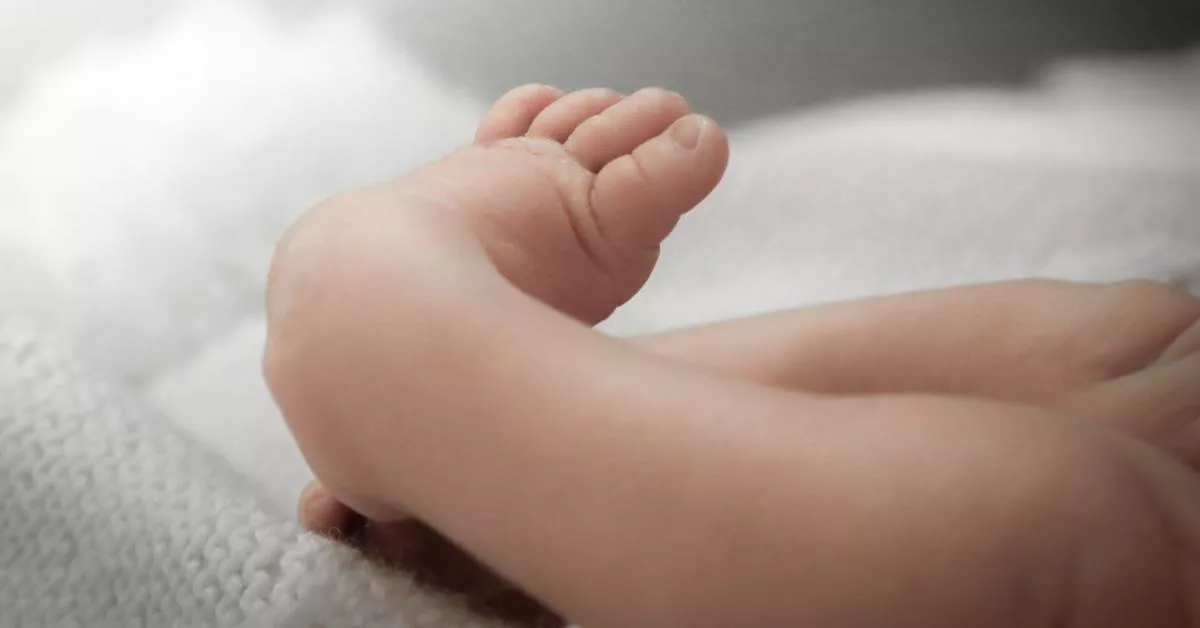 4 Faktor yang Meningkatkan Risiko Bayi Terkena Clubfoot