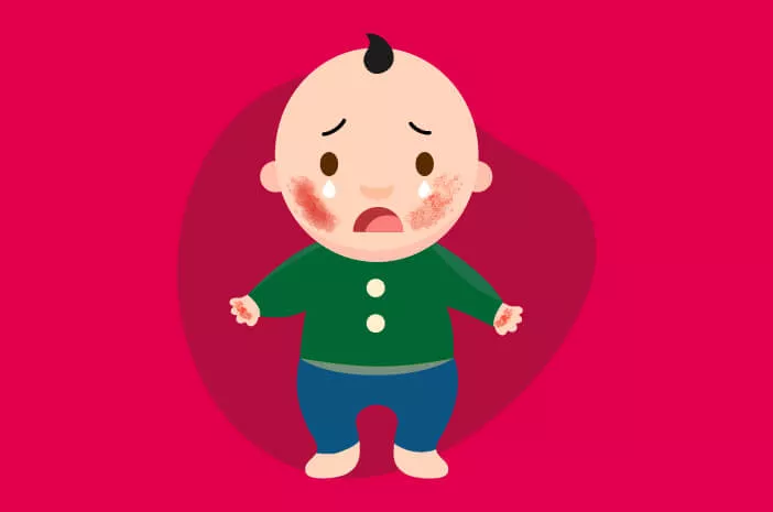5 Penyebab Umum Dermatitis Atopik pada Bayi