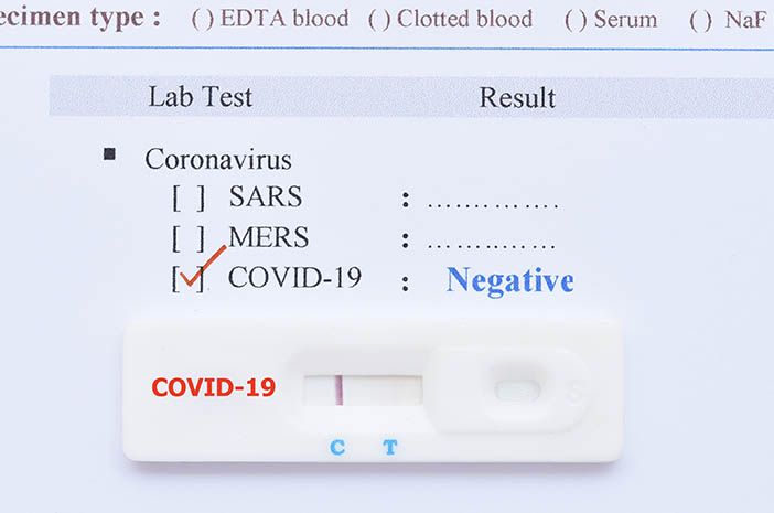 Tes COVID-19 Sebelum Naik Pesawat, Pilih Swab Antigen atau PCR?