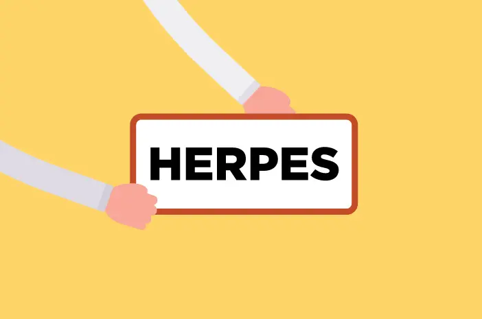 Jangan Percaya Mitos tentang Herpes Ini