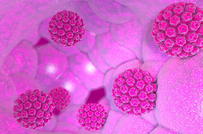 Ini Penyakit-Penyakit yang Disebabkan Virus HPV