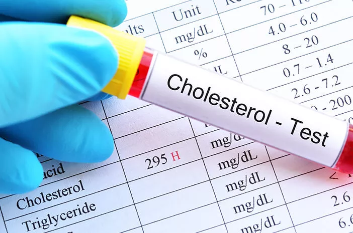 Kolesterol Naik setelah Lebaran, Lakukan 5 Hal Ini
