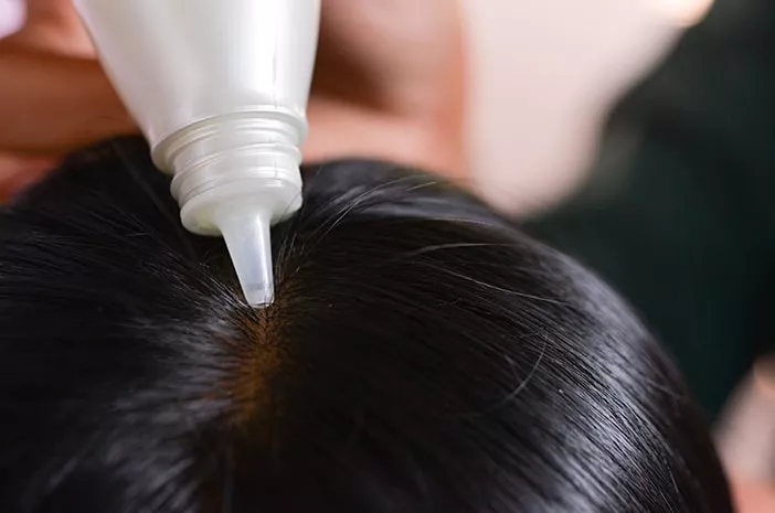 Mitos atau Fakta, Hair Tonic Bisa Atasi Rambut Rontok