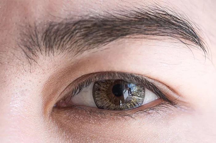 Kenali Gejala dari Keratitis yang Mengganggu Kesehatan Mata