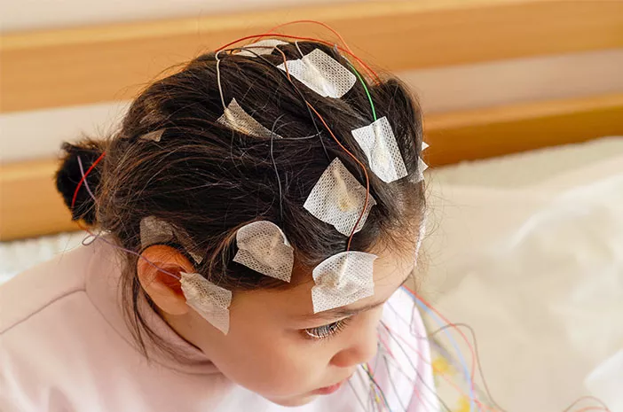 Usai Operasi Kepala, EEG dan Brain Mapping Perlu Dilakukan