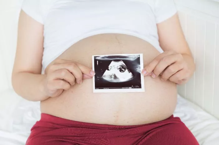 Hal Ini Bisa Diketahui dari USG 3D Kehamilan