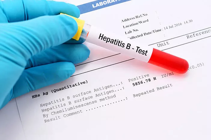 Ketahui Faktor yang Tingkatkan Risiko Terkena Hepatitis B