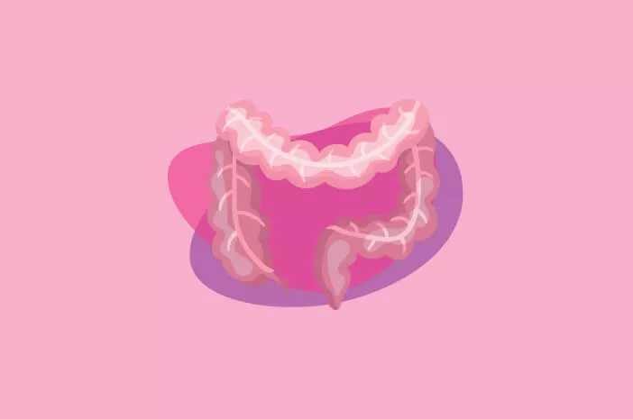 Kenali Fakta-Fakta Penting tentang Crohn's Disease