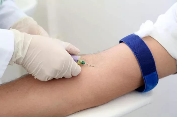 Alasan Pemeriksaan Darah Penting Bagi Pengidap Hiperhidrosis