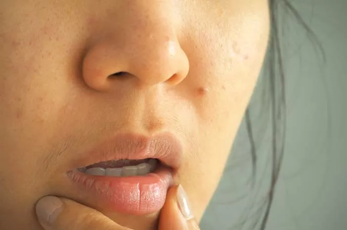 Mulut Kering Bisa Jadi Tanda Masalah Kesehatan?