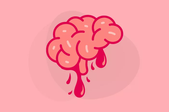 Sama-Sama Perdarahan Otak, Ini Bedanya Perdarahan Subarachnoid dan Perdarahan Intraserebral 