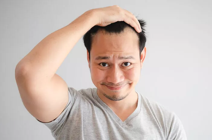 Cegah Botak, Ini Cara Mengatasi Rambut Rontok