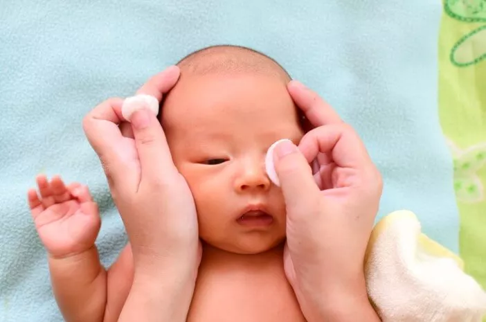 Mata Bayi Belekan, Begini Cara Mengatasinya
