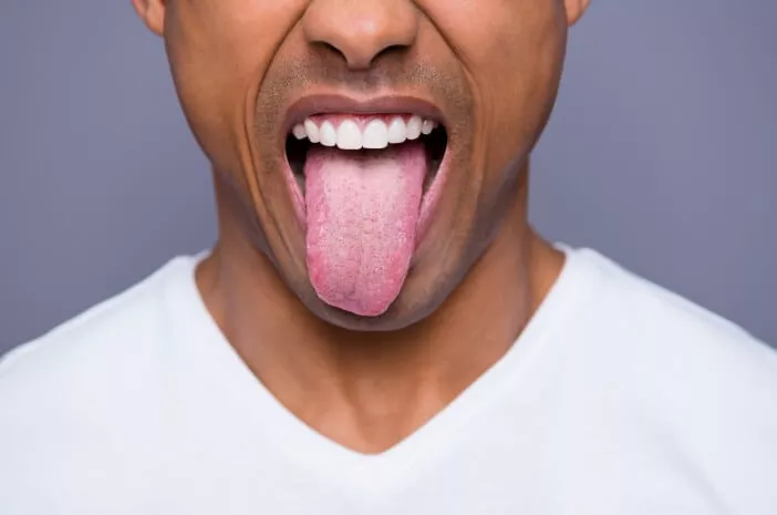 7 Gejala Oral Thrush yang Perlu Diwaspadai 