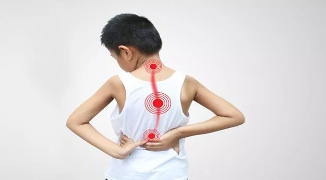 Ini Perawatan yang Tepat Bagi Anak Penderita Skoliosis