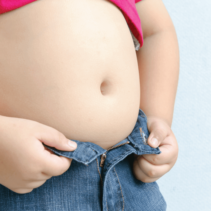 Pahami Cara Mengatasi Anak Obesitas Berikut Ini