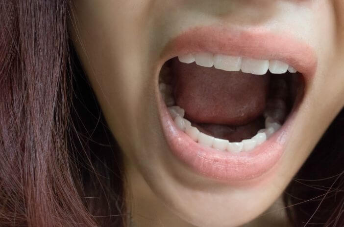   Begini Diagnosis untuk Deteksi Oral Thrush dengan Tepat 