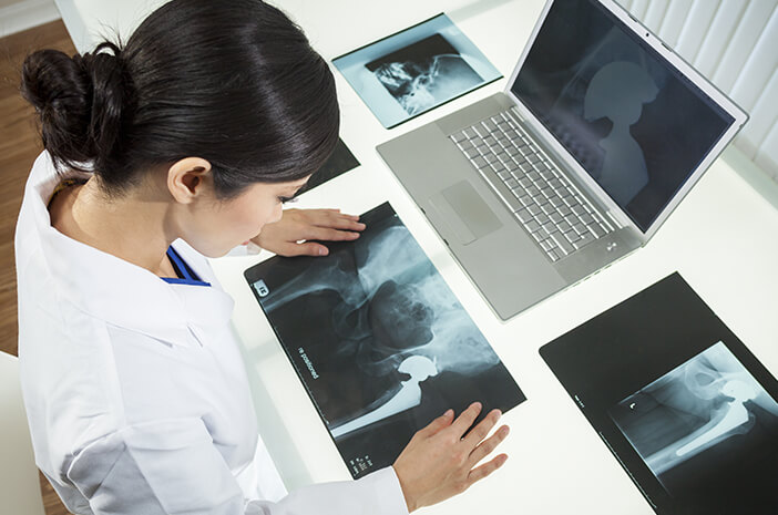 begini-cara-diagnosis-patah-tulang-panggul-yang-tepat-halodoc begini-cara-diagnosis-patah-tulang-panggul-yang-tepat-halodoc
