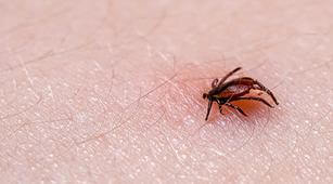 Bella Hadid Pernah Terkena Lyme Disease, Penyakit Apa Itu?