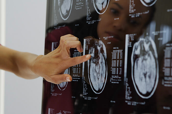 Belum Ada Obatnya, Waspada Encephalomalacia