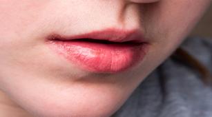 Bibir Kering Saat Puasa, Atasi dengan 4 Cara Ini