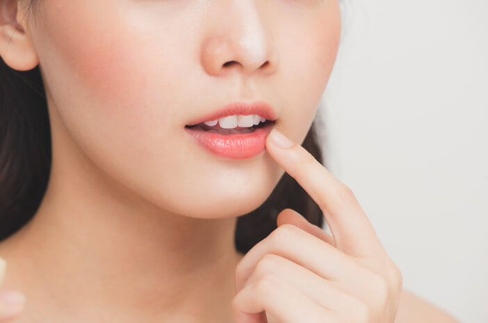 Bibir Pecah Saat Puasa, Atasi dengan 4 Cara Ini Bibir Pecah Saat Puasa, Atasi dengan 4 Cara Ini