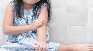 Biduran pada Anak Gejala Alergi Cuaca?