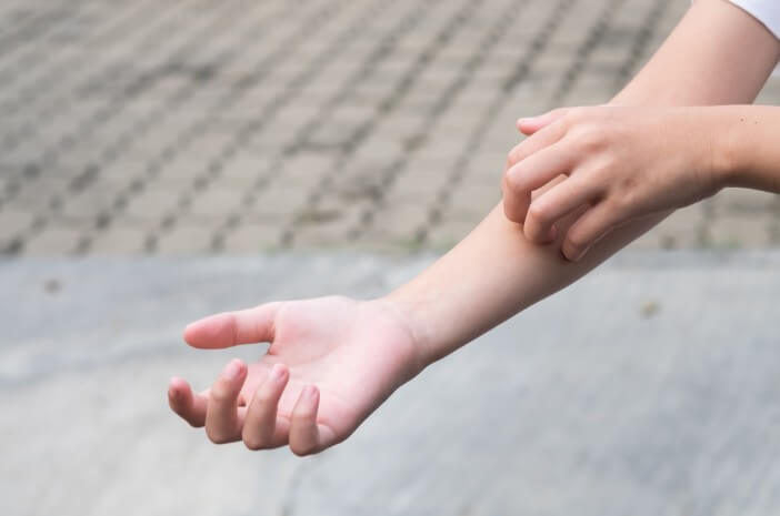 Bikin Kulit Gatal, Ini 6 Pengobatan Dermatitis Kontak Bikin Kulit Gatal, Ini 6 Pengobatan Dermatitis Kontak