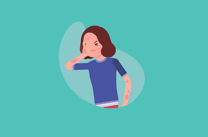 Bikin Kulit Ruam, Ini Cara Diagnosis Pityriasis Rosea