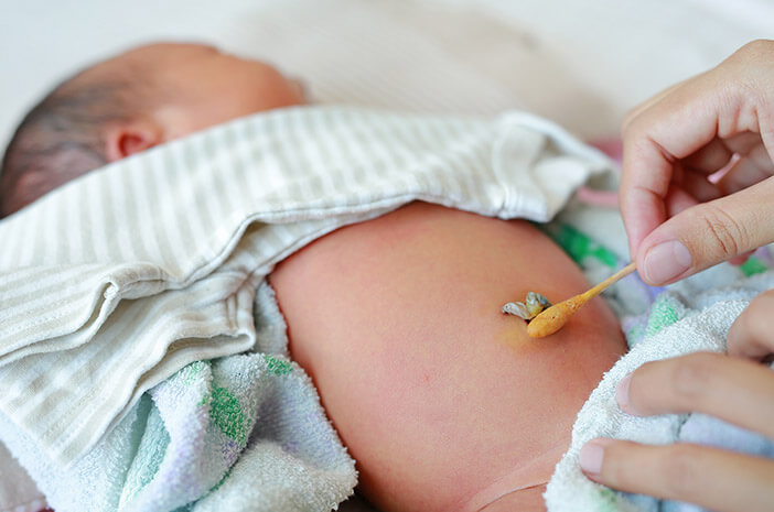Cara Merawat Tali Pusar Bayi agar Jauh dari Infeksi