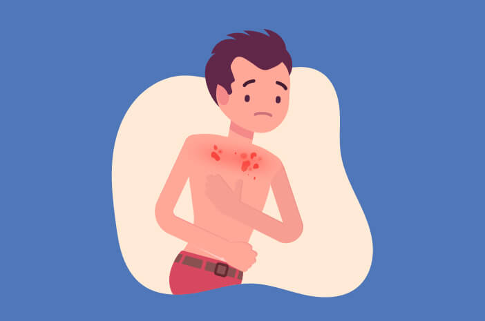 Dapatkah Dermatitis Numularis Menular?