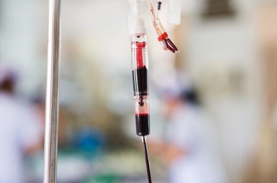 Darah Membeku Secara Abnormal Ini Tanda Dan Gejalanya Darah Membeku Secara Abnormal Ini Tanda Dan Gejalanya