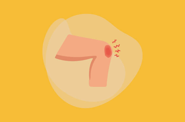 Gejala Osgood Schlatter Disease yang Bisa Dialami Si Kecil
