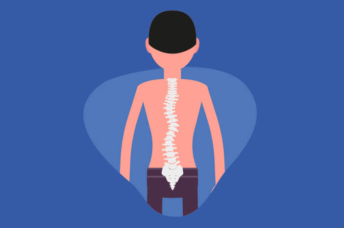 Hal yang Terjadi pada Tubuh Ketika Terserang Osteopetrosis