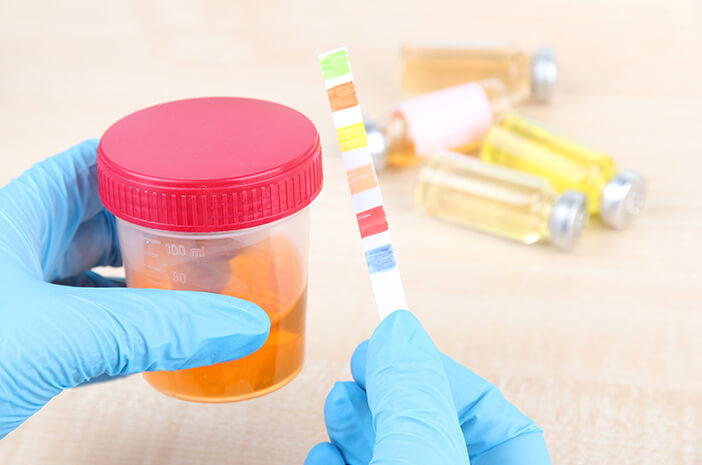 Ketoasidosis Diabetik Ketoasidosis Diabetik