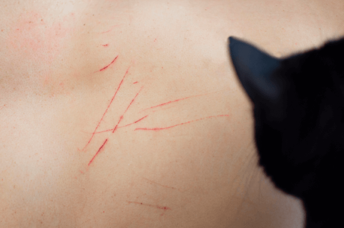 Hati-Hati Cakaran Kucing Sebabkan Infeksi Berbahaya