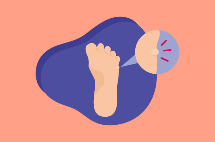 Heloma pada Kaki, Ini yang Perlu Diketahui