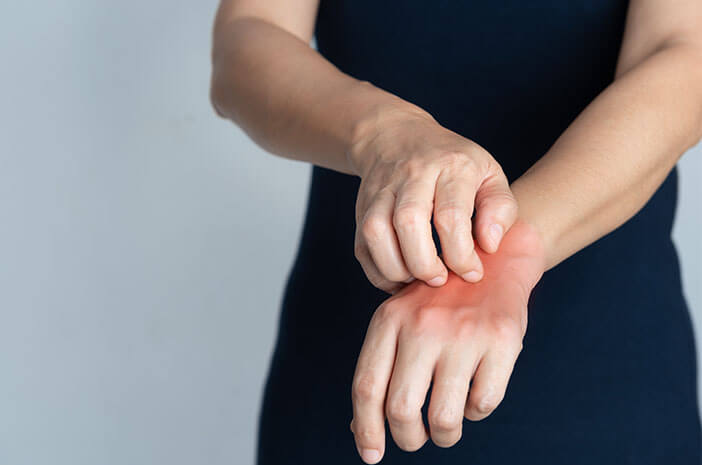 Hubungan Sindrom Sjogren dengan Dermatitis Herpetiformis