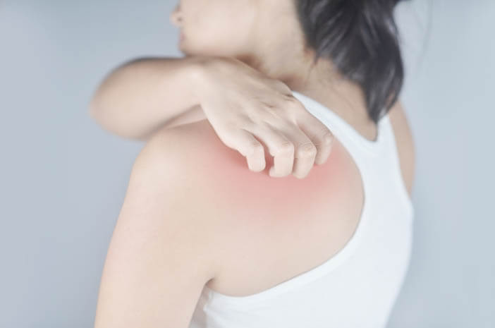 Ini Jenis-jenis Psoriasis yang Perlu Diketahui Ini Jenis-jenis Psoriasis yang Perlu Diketahui