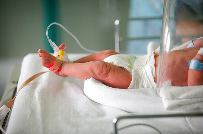 Jangan Diabaikan, 6 Komplikasi Necrotizing Enterocolitis Jangan Diabaikan, 6 Komplikasi Necrotizing Enterocolitis