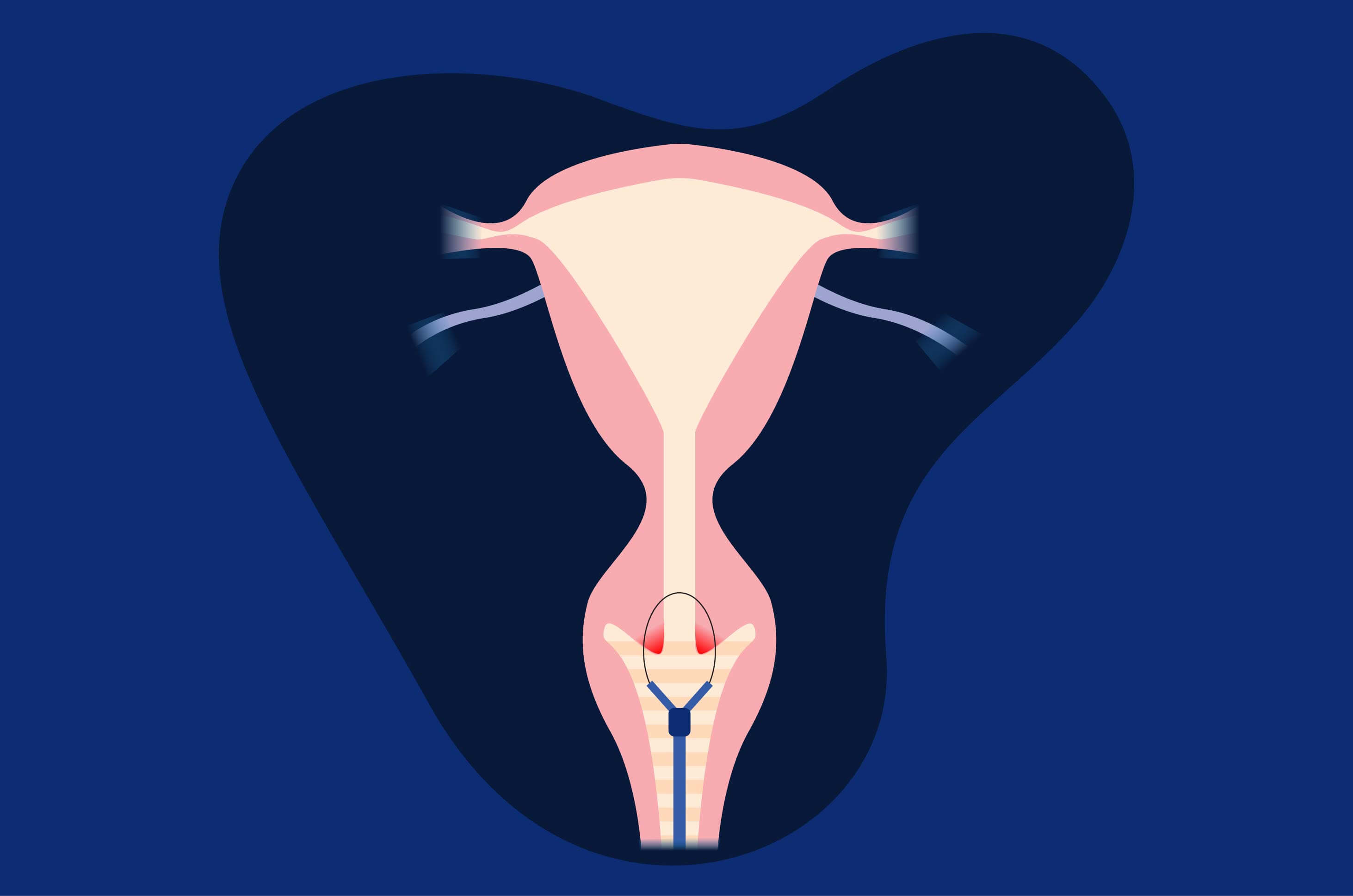 Yetuk videolar bilan rus porno Qiz porno videoda hammaga oral jinsiy aloqa qiladi