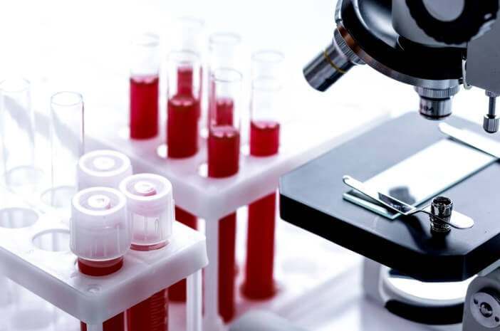 Kenali Prosedur Diagnosis Hiponatremia Kenali Prosedur Diagnosis Hiponatremia